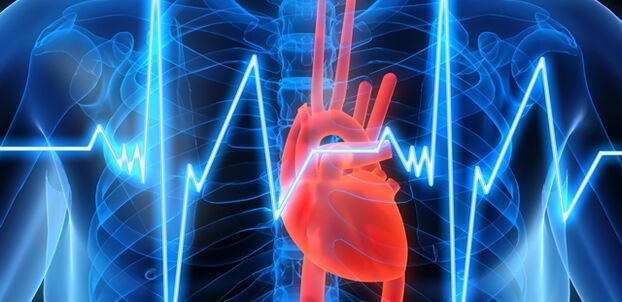 Гръдната остеохондроза може да бъде придружена от болка в областта на сърцето. 